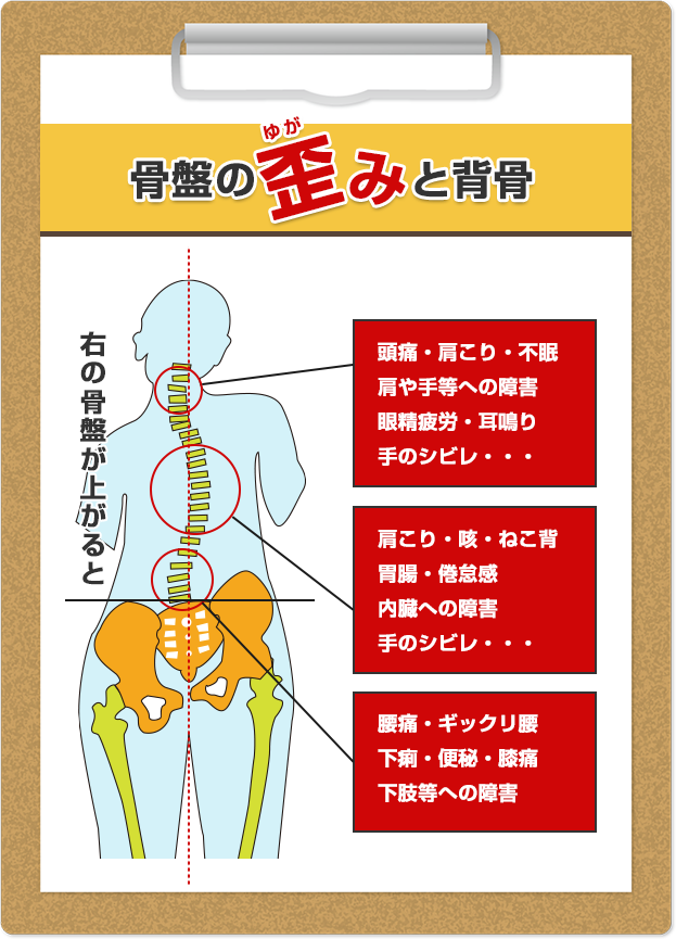 骨盤の歪みと背骨